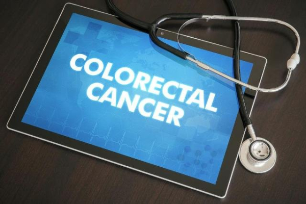 Colon cancer screening program reduced cases and deaths, eliminated racial gaps