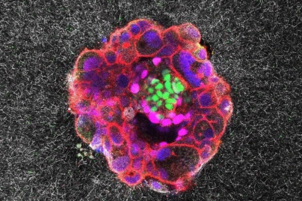 'Astonishing' video shows human embryo implanting in real time