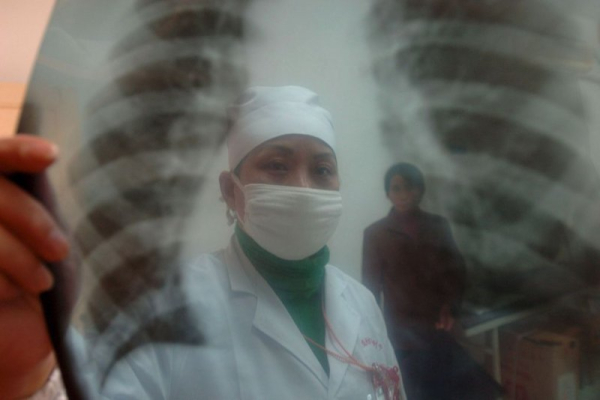 Device to find tumors deep in lungs shows promise in clinical trial