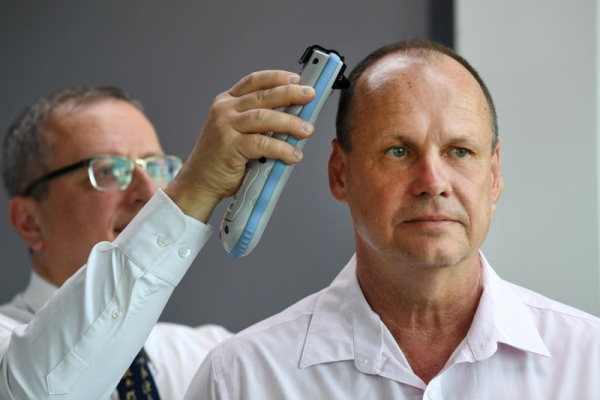 Study suggests concussions could be early ALS warning sign