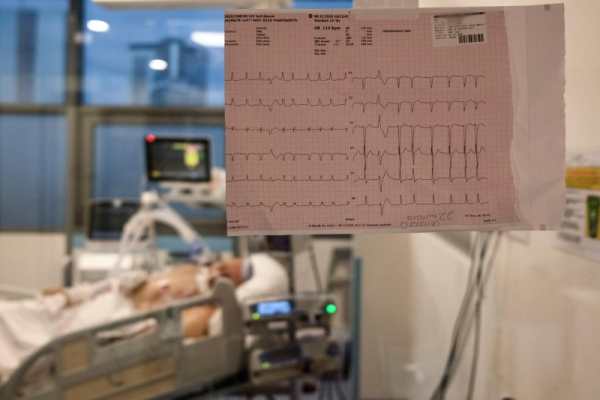 Study finds money worries increase speed of heart aging